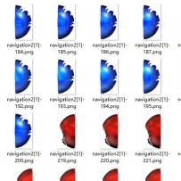 新UI的动态血球